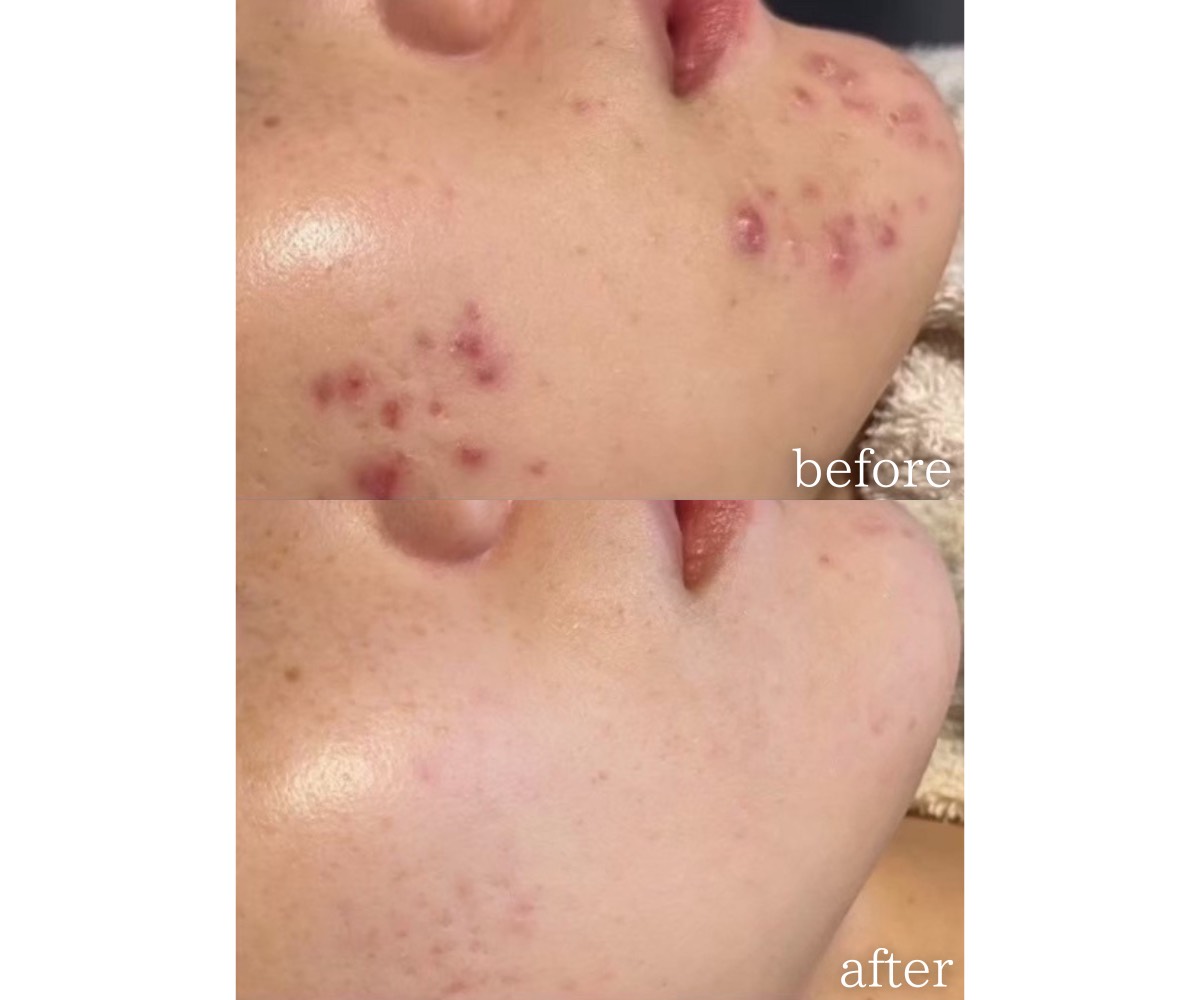 お顔の施術事例