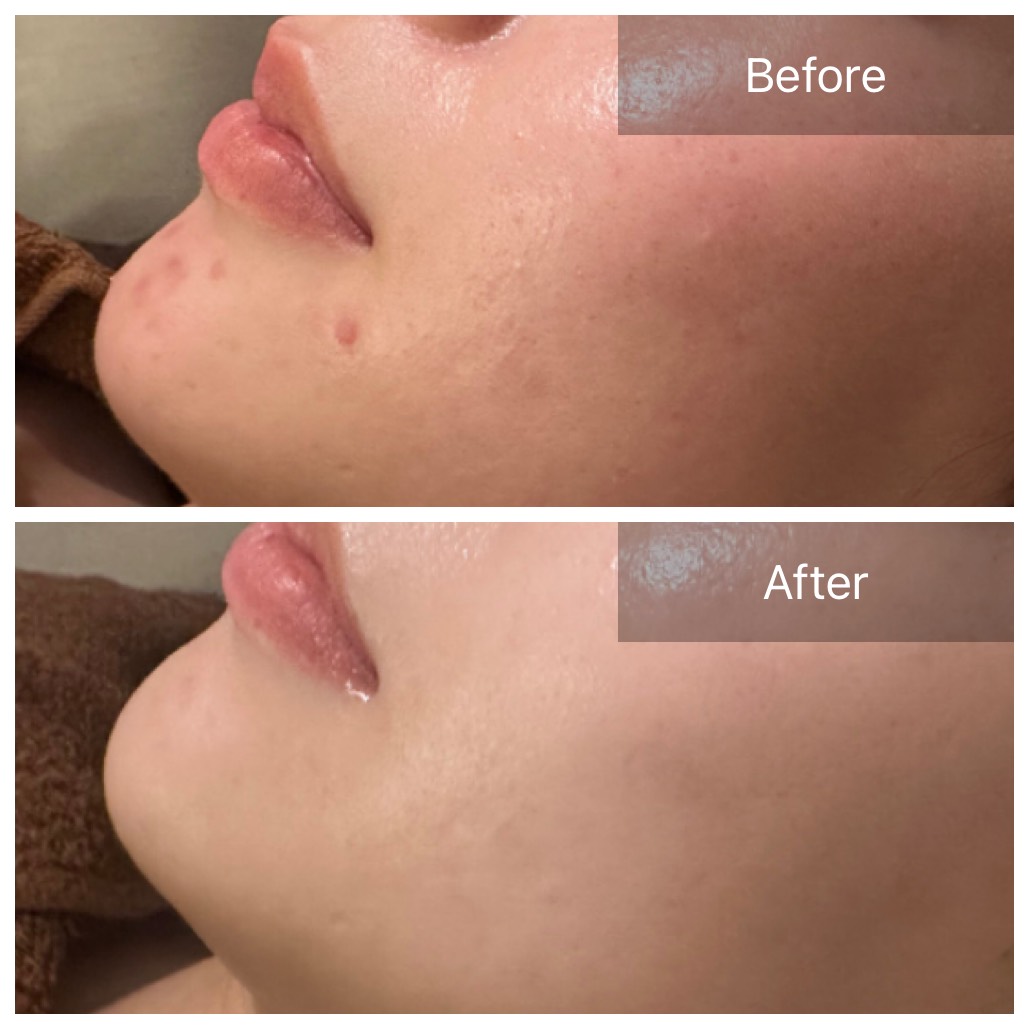 フェイシャルケア画像2